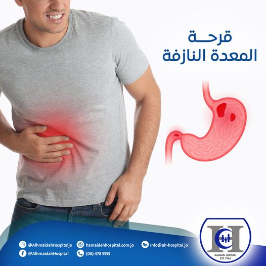 قرحة المعدة النازفة