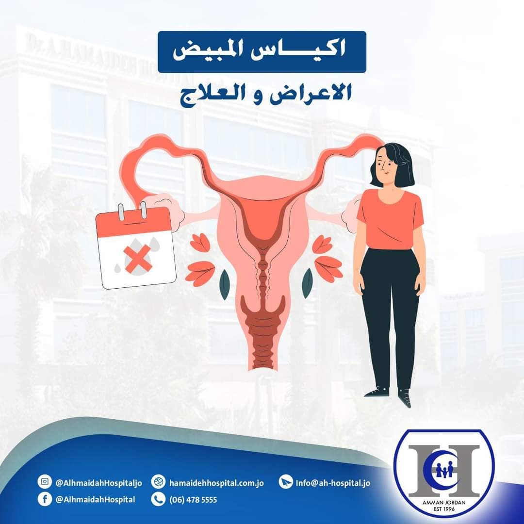 اكياس المبيض – الاعراض و العلاج